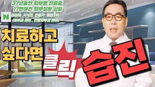 4K)습진의 원인과 치료방법은?습진은 모든 음식을 섭취하면서 치료할 수 있다.