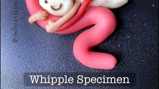 Playdough Surgery  - Whipple Procedure - Gross Exam - Part II