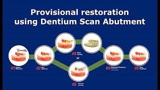 Provisional restoration using Dentium Scan Abutment