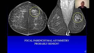 The probably benign lesion: definition, evaluation and management