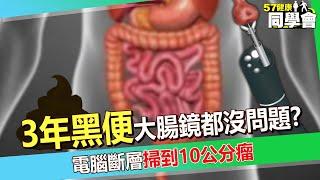 60歲翁「3年黑便」胃鏡、大腸鏡都沒問題？！電腦斷層「掃到10公分瘤」切這器官保命【 @57healthy  】#陳榮堅 醫師