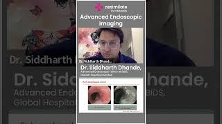 Advanced Endoscopic Imaging | @MedvarsityOnlineLtd