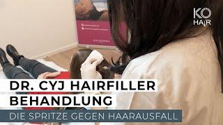 Innovativer Dr. Cyj Hairfiller gegen Haarausfall - KÖ-HAIR Klinik Düsseldorf