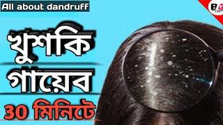 Dandruff treatment at home in bangla