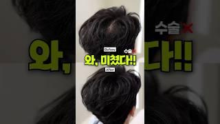 연예인들 다 이렇게 가린다는데?🫢 가르마, 정수리 커버하기 | 청담 연예인 헤어디자이너 꿀팁