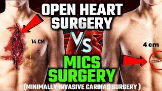 Minimally Invasive Cardiac Surgery in India | Benefits of MICS | Best Heart Hospital in India