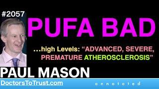 PAUL MASON a2 | PUFA BAD  …high Levels: “ADVANCED, SEVERE,  PREMATURE ATHEROSCLEROSIS”