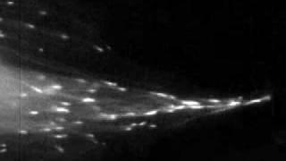 Microtubule Dynamics