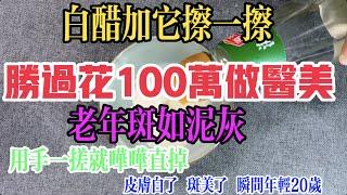 白醋加它擦一擦，勝過花100萬做醫美，老年斑如泥灰，用手一搓就嘩嘩直掉！皮膚白了，斑沒了！瞬間就年輕了20歲！【百變小廚坊】