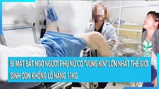 Bí mật bất ngờ người phụ nữ có “vùng kín” lớn nhất thế giới, sinh con khổng lồ nặng 11kg