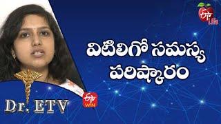 Vitiligo - Treatment | విటిలిగో సమస్య - పరిష్కారం | Dr.ETV | 27th June 2022 | ETV Life