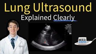 Lung Ultrasound Explained (Point of Care, Bedside, Clinical)