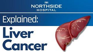 Liver Cancer Explained- Symptoms & Prevention of Liver Cancer