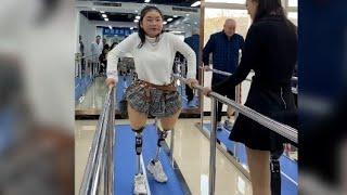 Amputee women challenge their disability with an artificial leg #amputee