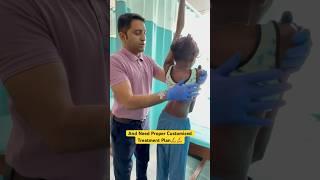 Most severe case of scoliosis chiropractic treatment by DrRavi #scoliosis #chiropractor #trending