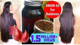 Homemade Onion & Curry Leaf Oil for Faster Hair Growth|Treat Baldness & Grey Hair|Sushmita's Diaries