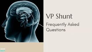 VP Shunt- Frequently Asked Questions