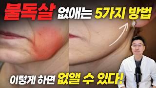 처진 불독살, 심술보, 마리오네트 라인 수술이 무서워 망설이고 있다면 바로 시청하세요.