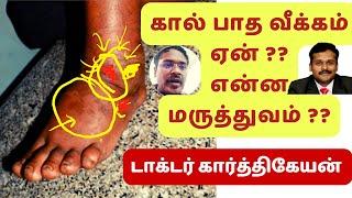 foot swelling treatment in tamil | dr karthikeyan-diabetes | கால் வீக்கம் எதனால் ஏற்படுகிறது