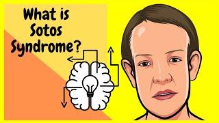 What is Sotos Syndrome? made incredibly EASY