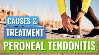 Peroneal Tendinopathy or Tendonitis - Causes & Treatment