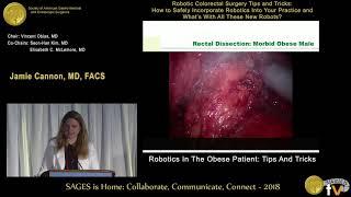 Robotic surgery & the morbidly obese