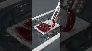 MagnetOs™ Flex Matrix | Medical Animation