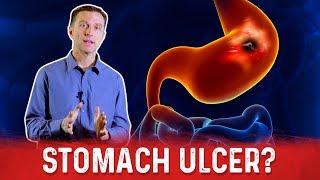 How To Get Rid Of Stomach Ulcer? – Dr.Berg On Peptic Ulcer Treatment