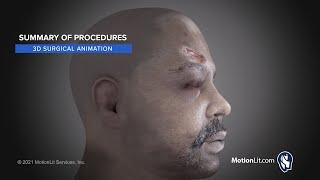 Surgical Animation Presents Summary of Injuries And Complex Procedures