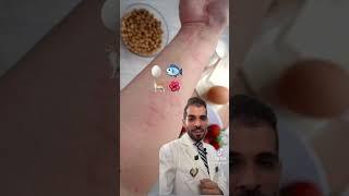 ماهو العامل المشترك لعلاج انواع الحساسية؟