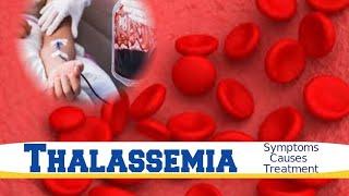 Thalassemia | Blood Dyscrasia | Hereditary Disease | Symptoms, Causes Diagnosis and Treatment