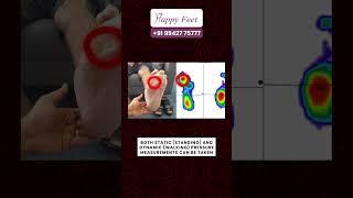 Fix your Diabetic Foot Ulcer with Customized Orthopaedic Shoes!