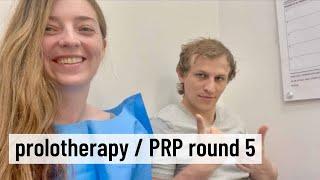 Prolotherapy & PRP Round 5 // Caring Medical Trip