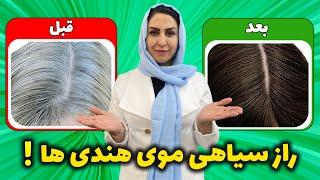 4 راز جلوگیری از سفیدی موها: برای همیشه موهای سفیدتو به موهای سیاه تبدیل کن!