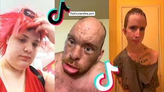 TikTok Encogido Cringe Compilación #18