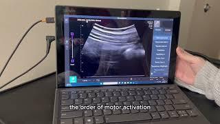 The Use of Ultrasound For Pelvic Floor Therapy