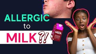 TOP Dairy Allergy Symptoms (Why MILK Makes You Sick) | Dr. Stacy Silvers