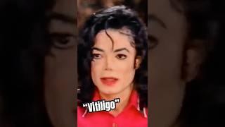Michael Sets The Record Straight About His Skin! #michaeljackson #kingofpop #shorts
