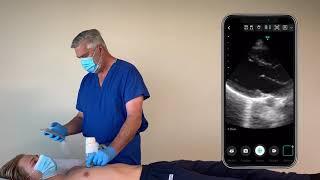 Scanning Demonstration of the Vave Wireless Ultrasound Solution