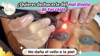 Elimina el Tattoo de Cejas #tatuaje #lásertatuajecorporal #lásertatuajefacial