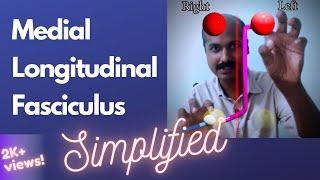 Video 1-Medial Longitudinal Fasciculus and conjugate gaze