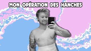 Liposuccion des hanches BMS // Ftm transgenre français // CRAZYDEN !