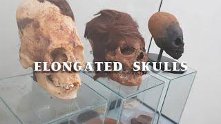 Elongated Skulls