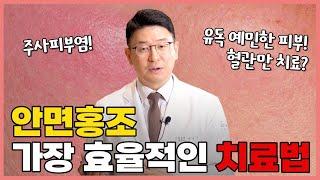 얼굴 붉어지는 안면홍조, 주사피부염 없애는 방법! 무조건 혈관만 없애면 손해인 이유