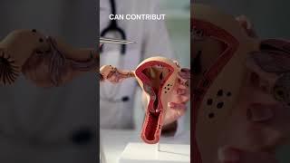 “Birth control for PCOS?