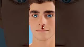 If Your Nose Starts To Bleed