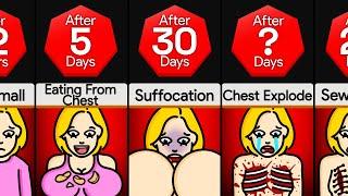 Timeline: What If Your Chest Never Stopped Growing