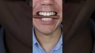 Nobel Super Soda Candy ASMR//#funny #comedy #fun #toton #subscribe #shorts