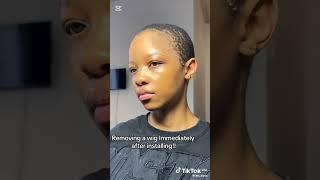 taking off wig with bad head