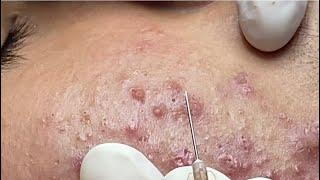 Priority preview content for registered members Spa Linh Mun #28